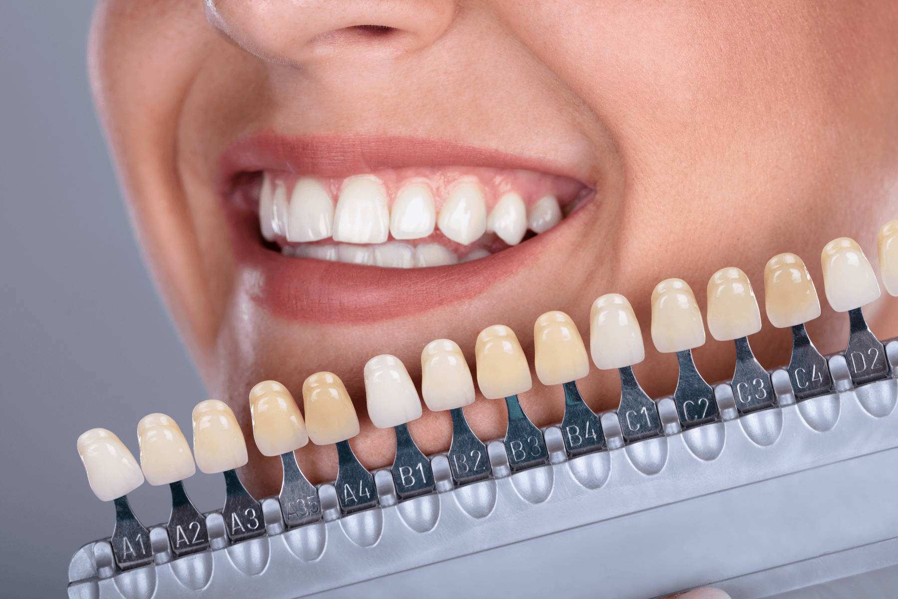 Teeth Whitening -  image